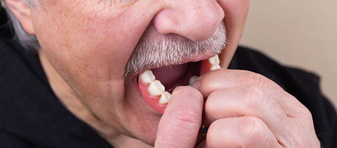 Secure Dental Adhesive ALTERNATIVE Keeps Dentures in Place